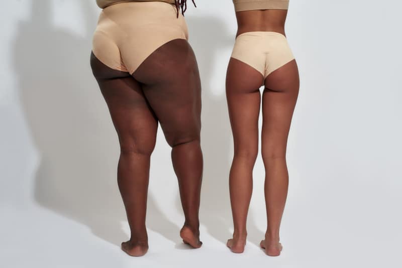 Back view of legs of two women in beige underwear after Spider Vein Removal