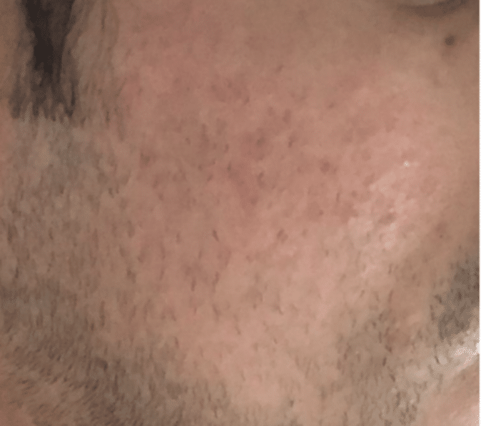After