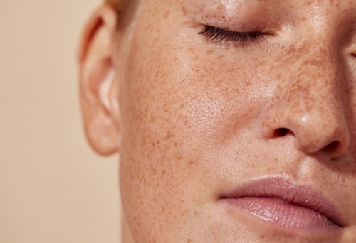 face of a young woman with freckles
