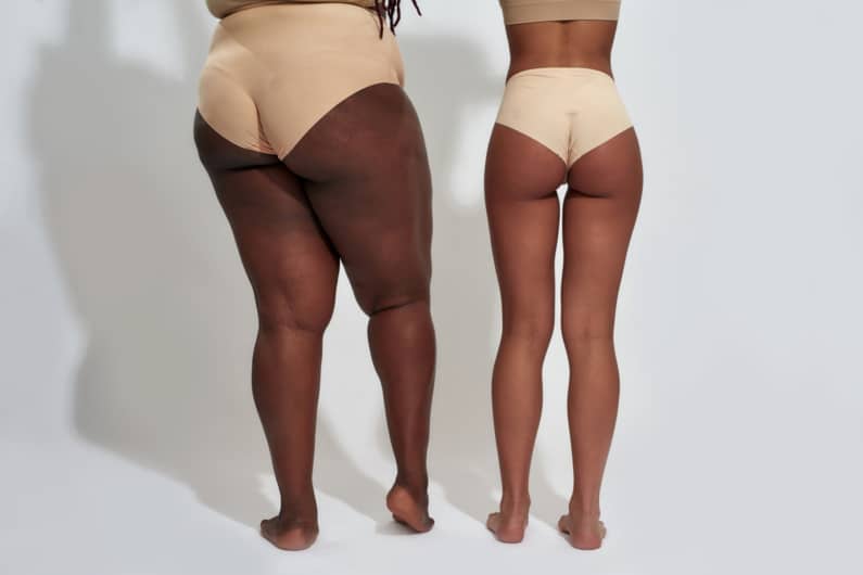 The GentleMax Pro: Spider Vein Removal for Darker Skin tones The GentleMax Pro: Spider Vein Removal for Darker Skin tones
